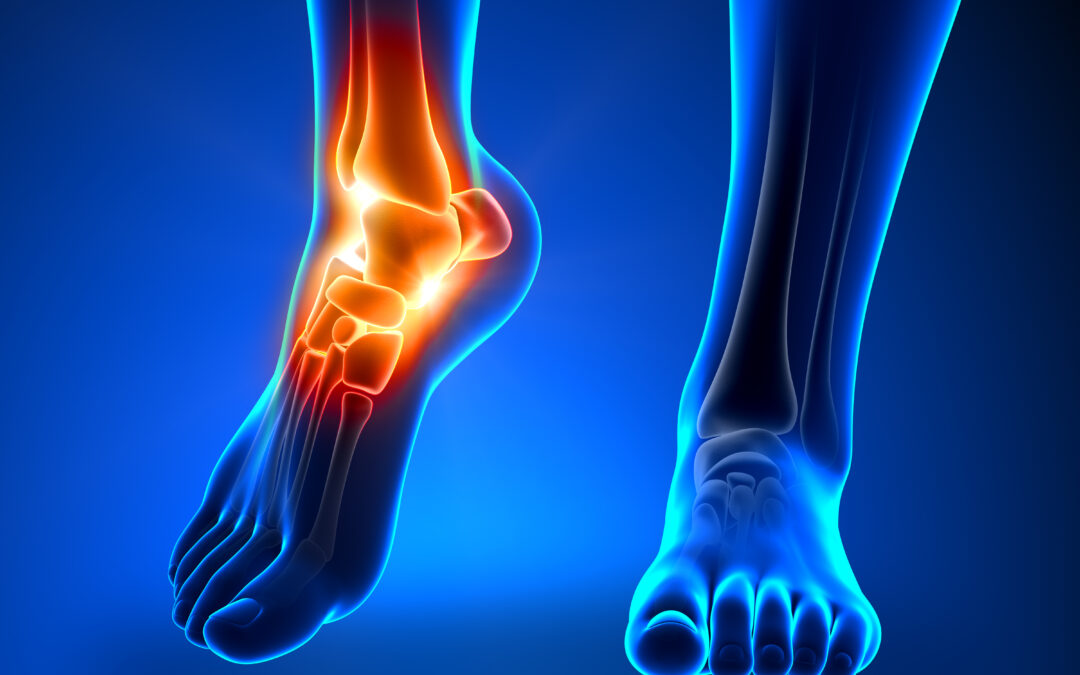 Chronic foot pain