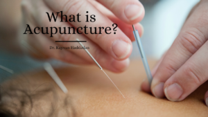 Kh What Is Acupuncture (1)